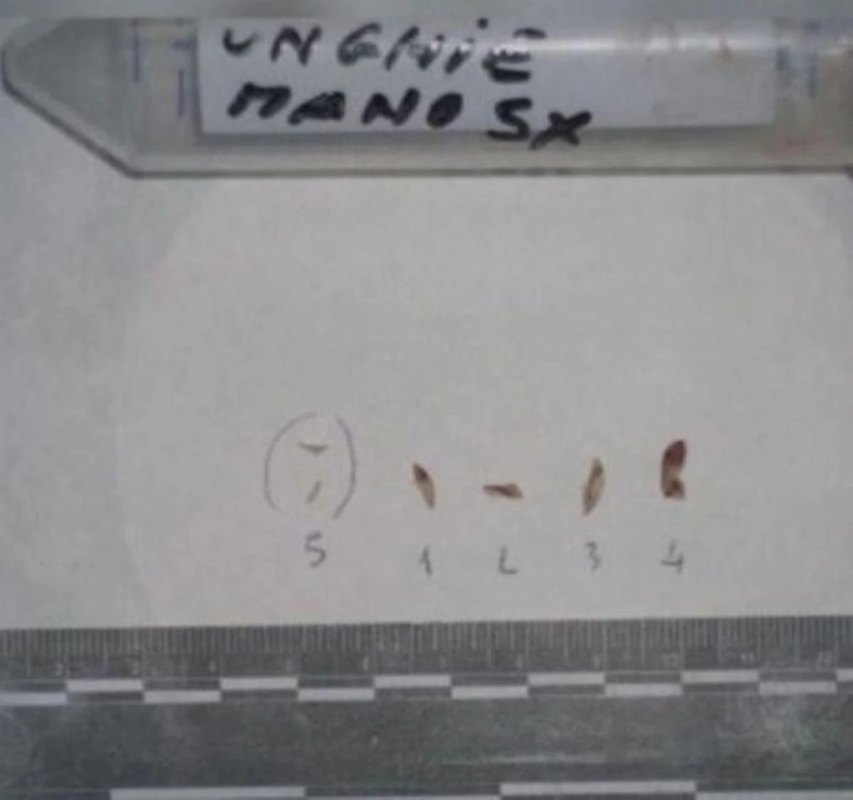 Dettaglio delle unghie di Chiara Poggi, focus delle nuove analisi genetiche