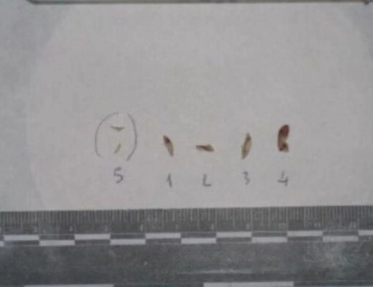 Materiale biologico raccolto dalle unghie di Chiara Poggi