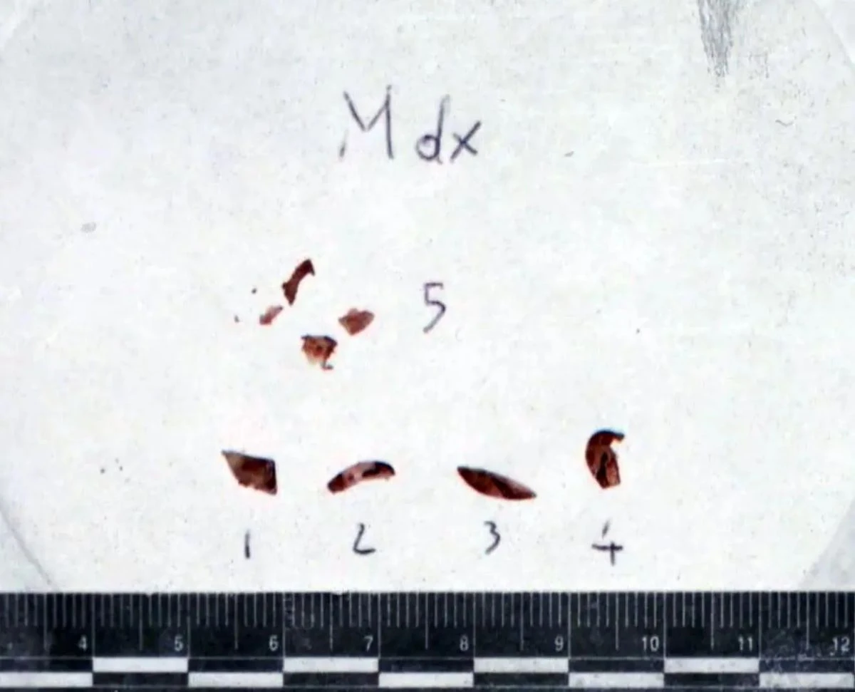 Dettaglio delle unghie di Chiara Poggi, elemento centrale nell'indagine genetica